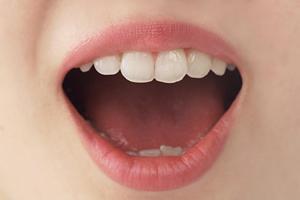 大阪で刺青除去ができる美容外科